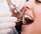 Revisión dental