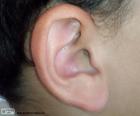 Oreja humana