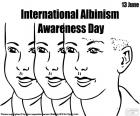Día Internacional de Sensibilización sobre el Albinismo