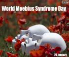 24 De Enero Dia Mundial Del Sindrome de Moebius, una compleja anomalía caracterizada por la parálisis facial y la incapacidad de mover los ojos lateralmente. Fue descrita por Paul Julius Möebius en el año 1884