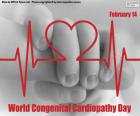 14 de febrero Día de Mundial de las Cardiopatías Congénitas. Las cardiopatías congénitas son alteraciones o malformaciones que ocurren en el corazón antes del nacimiento