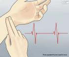 La frecuencia cardiaca es el número de veces que se contrae el corazón durante un minuto. La frecuencia normal en reposo oscila entre 50 y 100 latidos por minuto.
