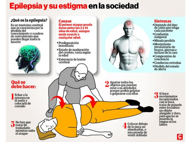 Se puede morir de epilepsia